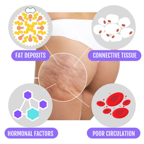 PLASTRY ANTYCELLULITOWE Warto™ – Gładka Skóra i Widoczne Efekty Już po Pierwszym Użyciu!