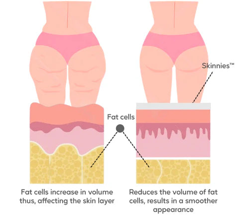PLASTRY ANTYCELLULITOWE Warto™ – Gładka Skóra i Widoczne Efekty Już po Pierwszym Użyciu!